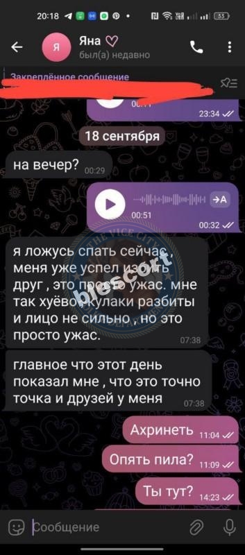 Яна Шипелева - ЧС эскорта Яна Шипелева - ЧС эскорта